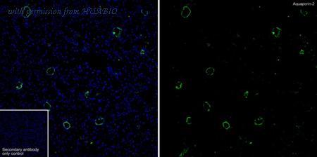 HUABIO HA751273 image 2