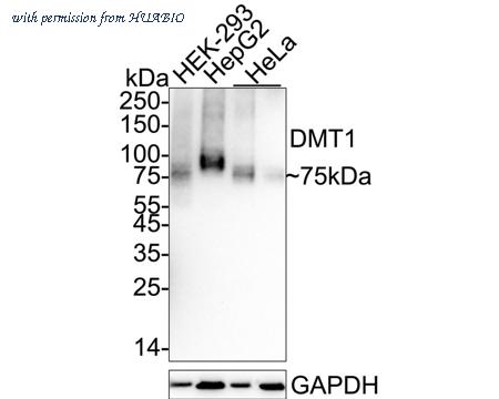 HUABIO HA751274 image 1