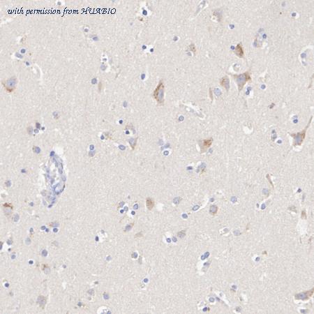 HUABIO HA751274 image 2