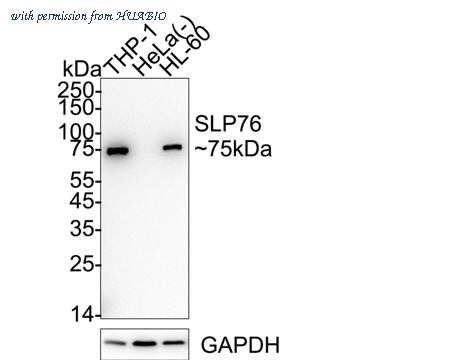 HUABIO HA751276 image 1