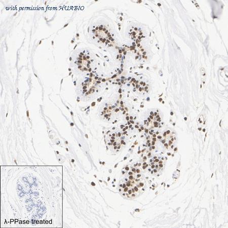 HUABIO HA751292 image 3