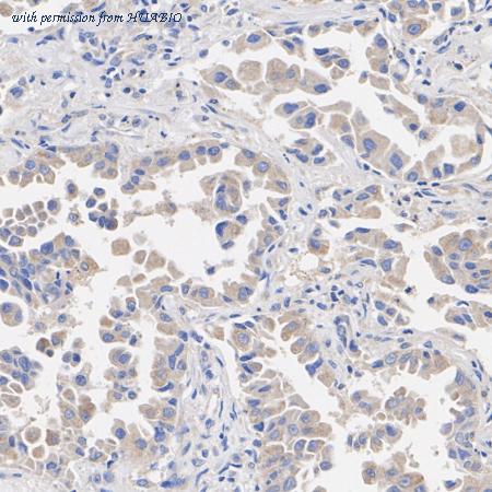 HUABIO HA751303 image 3