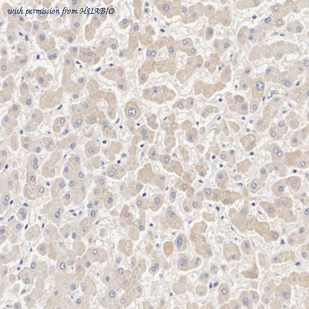 HUABIO HA751311 image 2