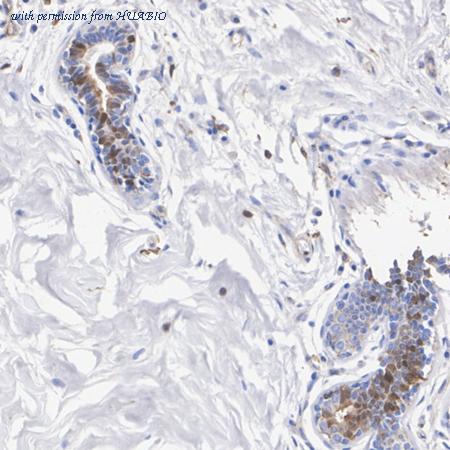 HUABIO HA751312 image 2