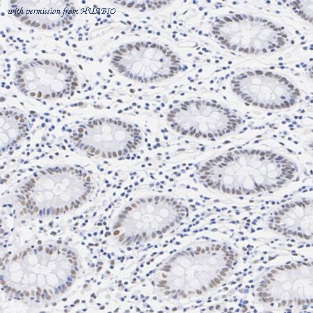 HUABIO HA751317 image 2