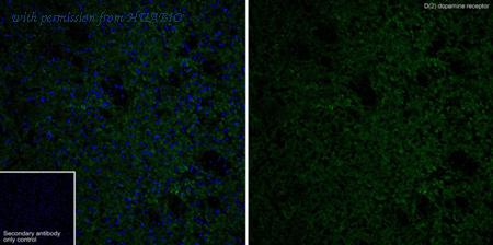 HUABIO HA751324 image 2