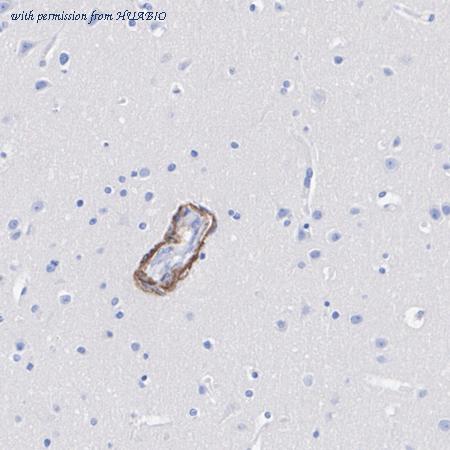 HUABIO HA751325 image 2