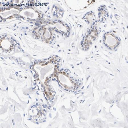 HUABIO HA751344 image 2