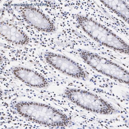 HUABIO HA751383 image 1