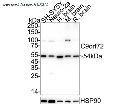 HUABIO HA751395 image 1