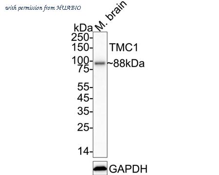HUABIO HA751396 image 1