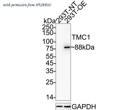 HUABIO HA751396 image 2