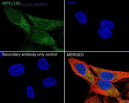 HUABIO HA751403 image 2