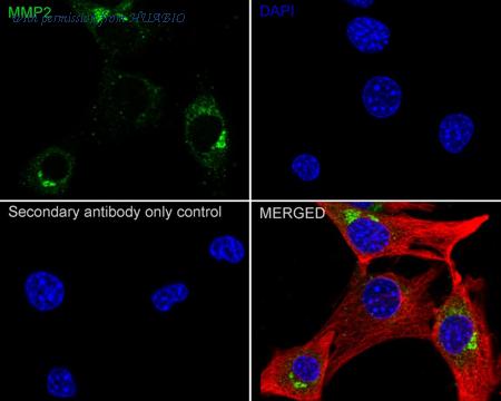 HUABIO HA751405 image 3