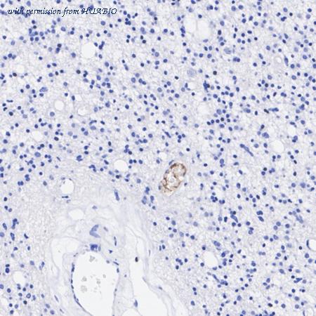 HUABIO HA751408 image 3