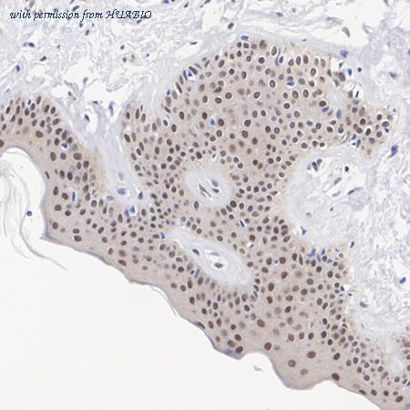 HUABIO HA751409 image 2