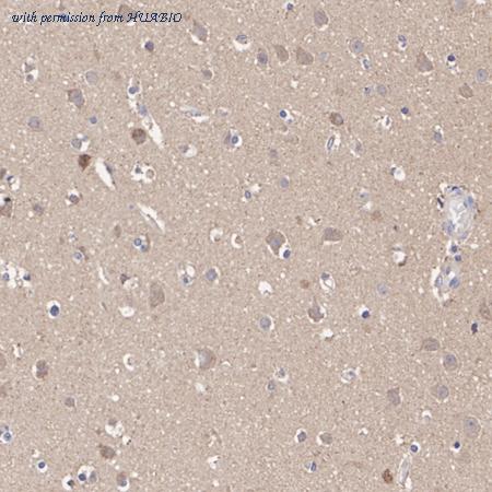 HUABIO HA751432 image 2