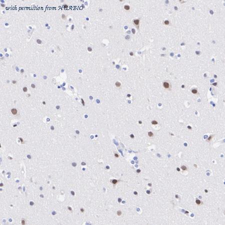 HUABIO HA751433 image 2