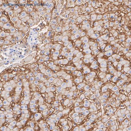 HUABIO HA751440 image 2