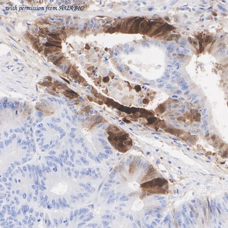 HUABIO HA751445 image 3