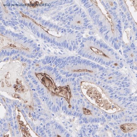 HUABIO HA751446 image 3