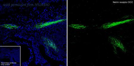 HUABIO HA751449 image 2