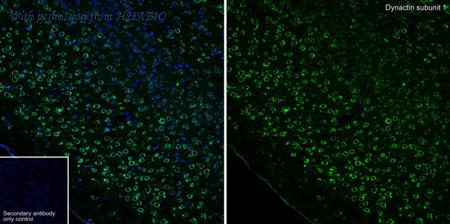 HUABIO HA751464 image 2