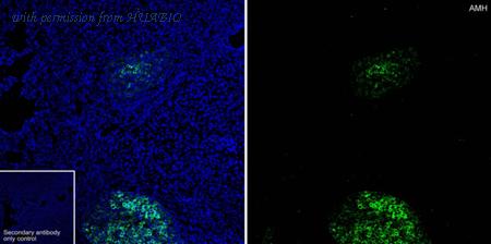 HUABIO HA751467 image 2