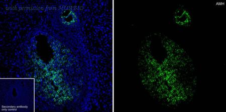 HUABIO HA751467 image 3