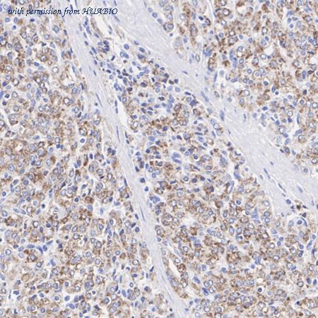 HUABIO HA751474 image 2