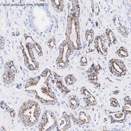 HUABIO HA751474 image 3