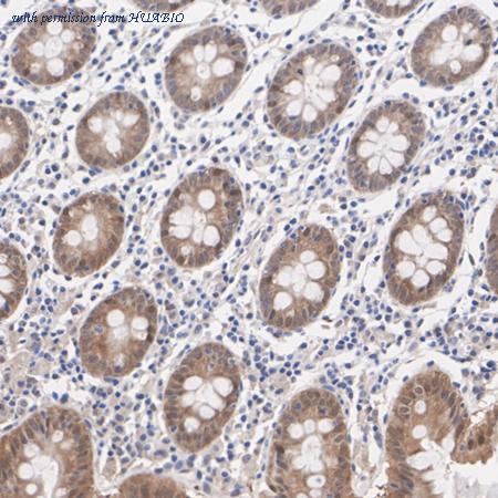 HUABIO HA751482 image 2