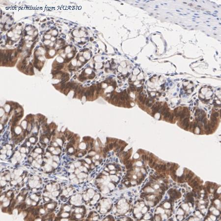 HUABIO HA751482 image 3