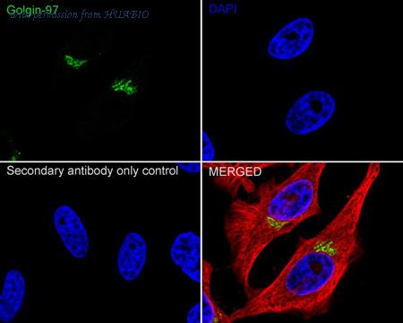 HUABIO HA751486 image 2