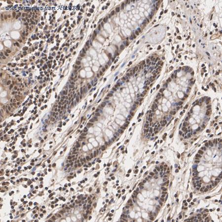 HUABIO HA751520 image 2