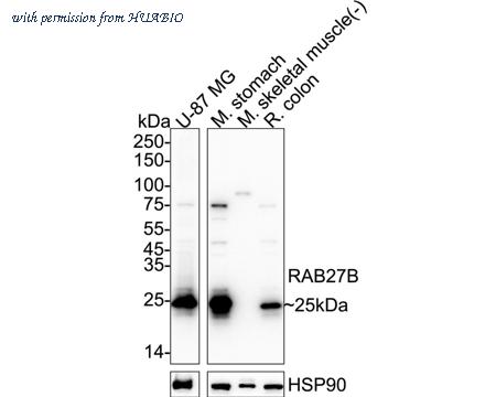 HUABIO HA751529 image 1