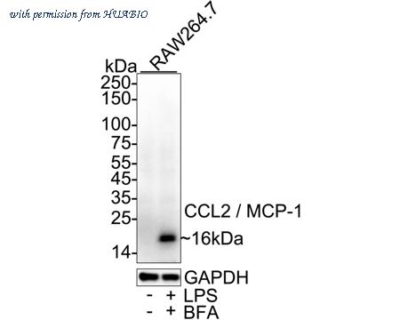 HUABIO HA751533 image 1