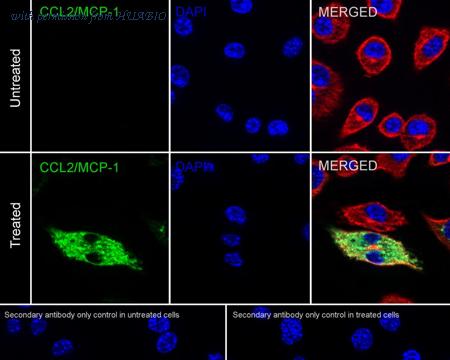 HUABIO HA751533 image 2