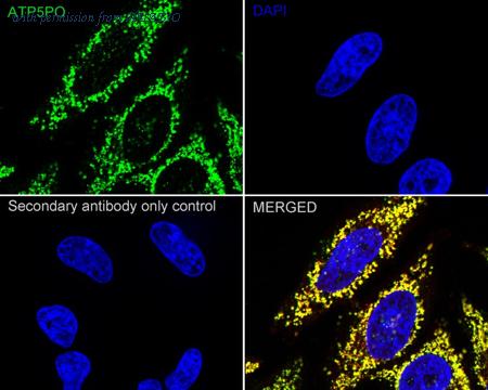 HUABIO HA751542 image 2