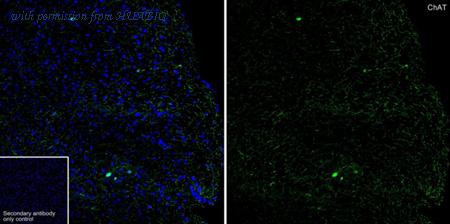 HUABIO HA751543 image 2