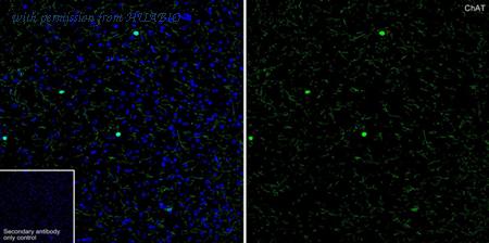 HUABIO HA751543 image 3