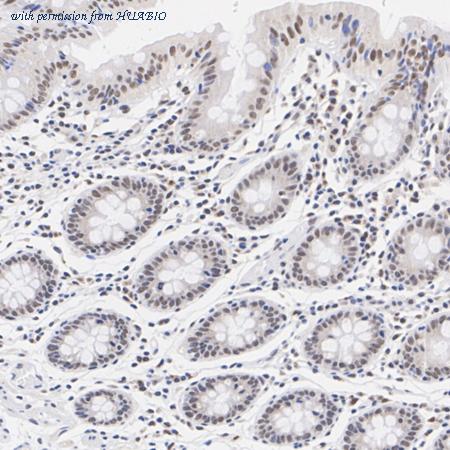 HUABIO HA751552 image 3