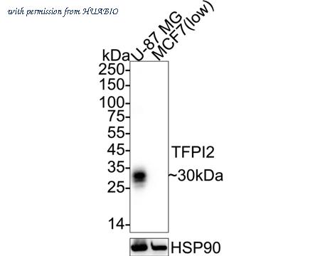 HUABIO HA751560 image 1