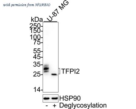 HUABIO HA751560 image 2