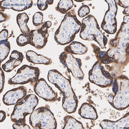 HUABIO HA751560 image 3