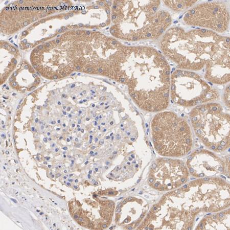 HUABIO HA751561 image 3