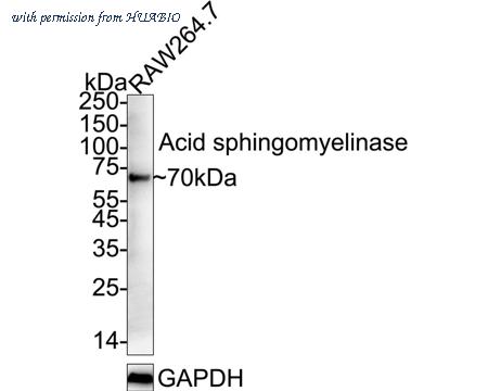 HUABIO HA751572 image 3