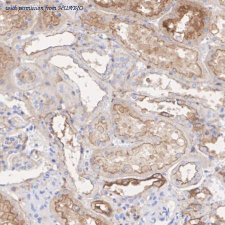 HUABIO HA751579 image 3