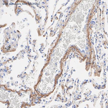 HUABIO HA751591 image 2