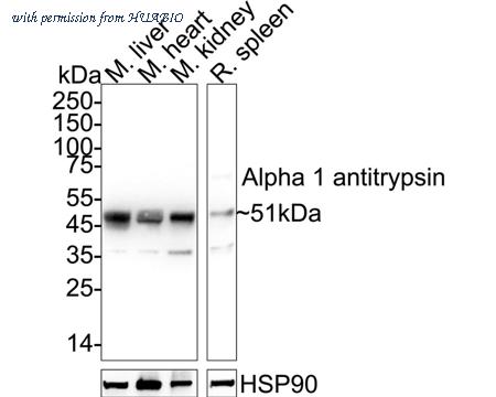 HUABIO HA751592 image 1